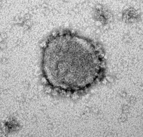Das neue Coronavirus, SARS-CoV-2