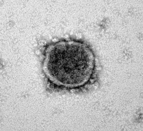 Elektronenmikroskopische Aufnahme eines SARS-CoV-2 Virions 