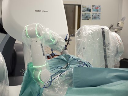 Am Universitätsklinikum Ulm assistierte der Roboterarm Cirq erstmals bei einer Wirbelsäulenoperation.